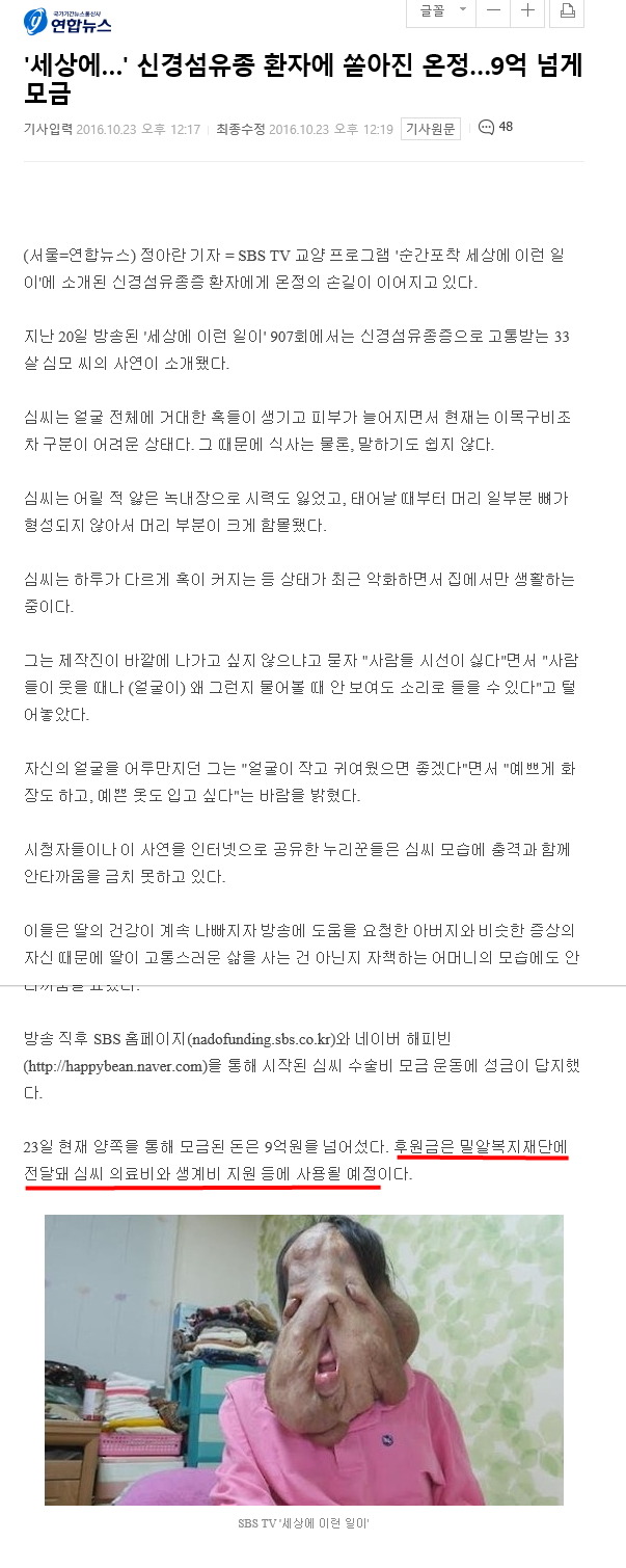 세상에 이런일이 신경섬유종 환자 후원금 기독교재단으로 전달되어 치료비로 사용된다 | 인스티즈