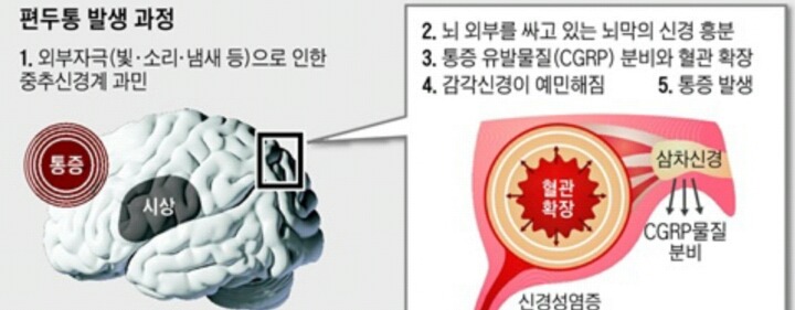 두통 심한사람 공감.txt | 인스티즈