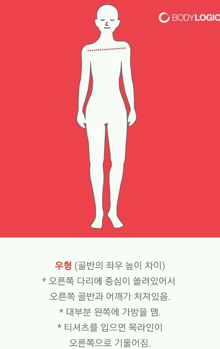 제자리걸음으로 골반틀어짐 확인하는 법 | 인스티즈