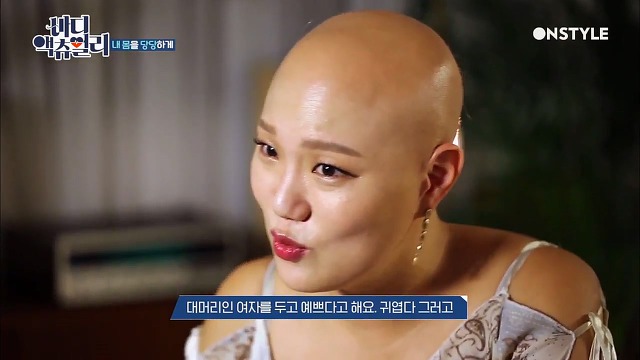 전신탈모증 윤사비나씨가 생각하는 아름다움.jpg | 인스티즈