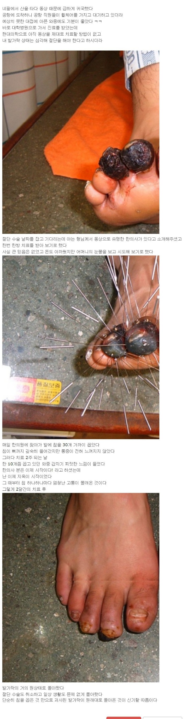 현대의학으로는 설명할수없다! | 인스티즈