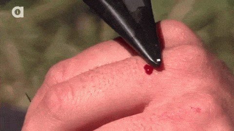 산미치광이라고도 불리우는 위험한 설치류.jpgif | 인스티즈